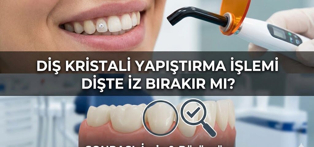 Diş kristali yapıştırma işlemi dişte iz bırakır mı