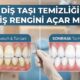 Diş taşı temizliği diş rengini açar mı