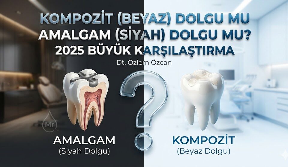 Kompozit dolgu mu amalgam dolgu mu