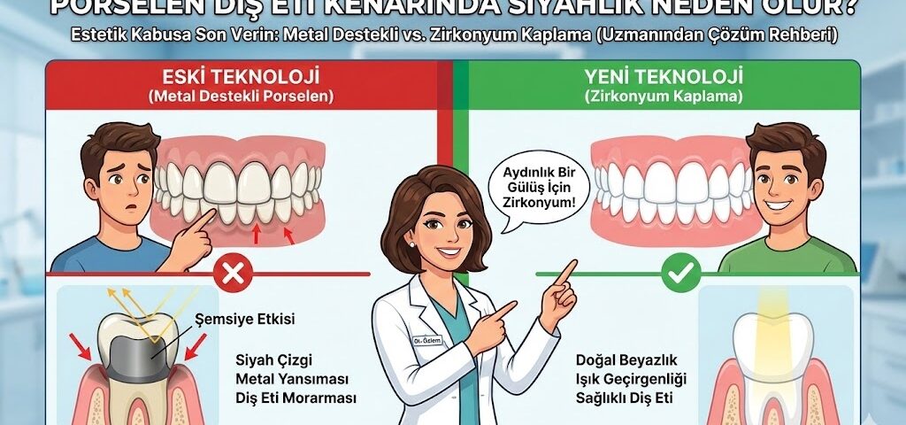 Porselen Diş Eti Kenarında Siyahlık Neden Olur