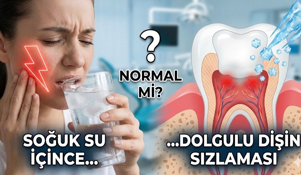 Soğuk su içince dolgulu dişin sızlaması