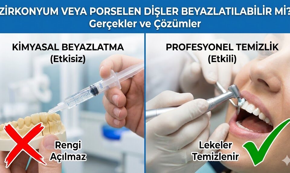 Zirkonyum veya Porselen Dişler Beyazlatılabilir mi