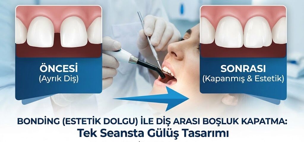 bonding ile diş arası boşluk kapatma