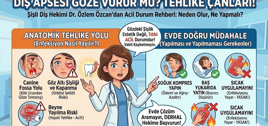 diş apsesi göze vurur mu