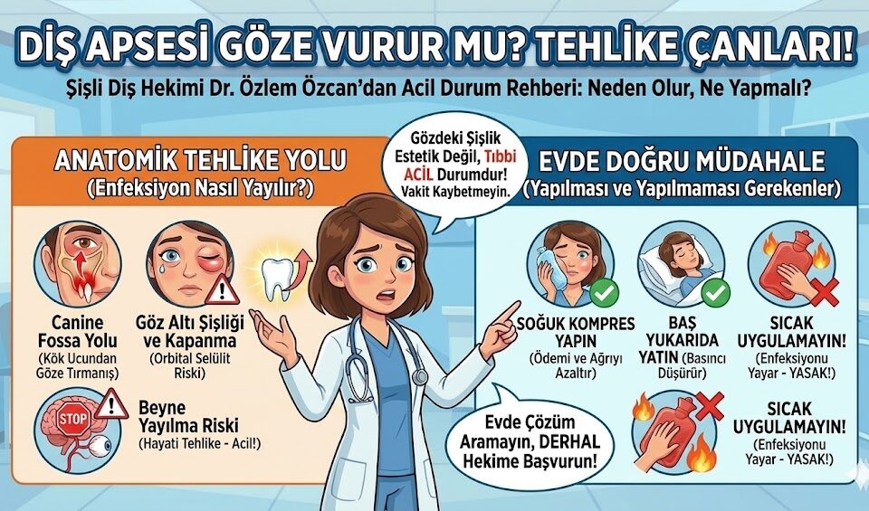 diş apsesi göze vurur mu