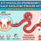 Diş Eti Hastalığı (Periodontitis) Kalp Sağlığını Etkiler mi? 3 diş eti hastalığı kalp sağlığını etkiler mi