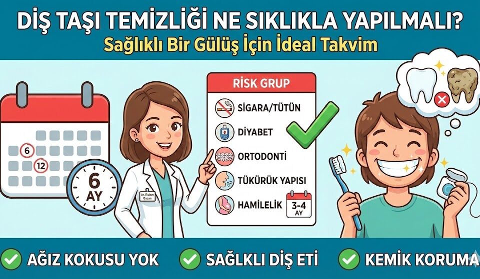 diş taşı temizliği ne sıklıkla yapılmalı