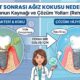 İmplant Sonrası Ağız Kokusu Neden Olur