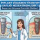 implant vidasının titanyum saflığı neden önemlidir