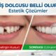ön diş dolgusu belli olur mu