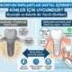 zirkonyum implantlar kimler için uygundur
