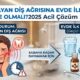 zonklayan diş ağrısına evde ilk müdahale