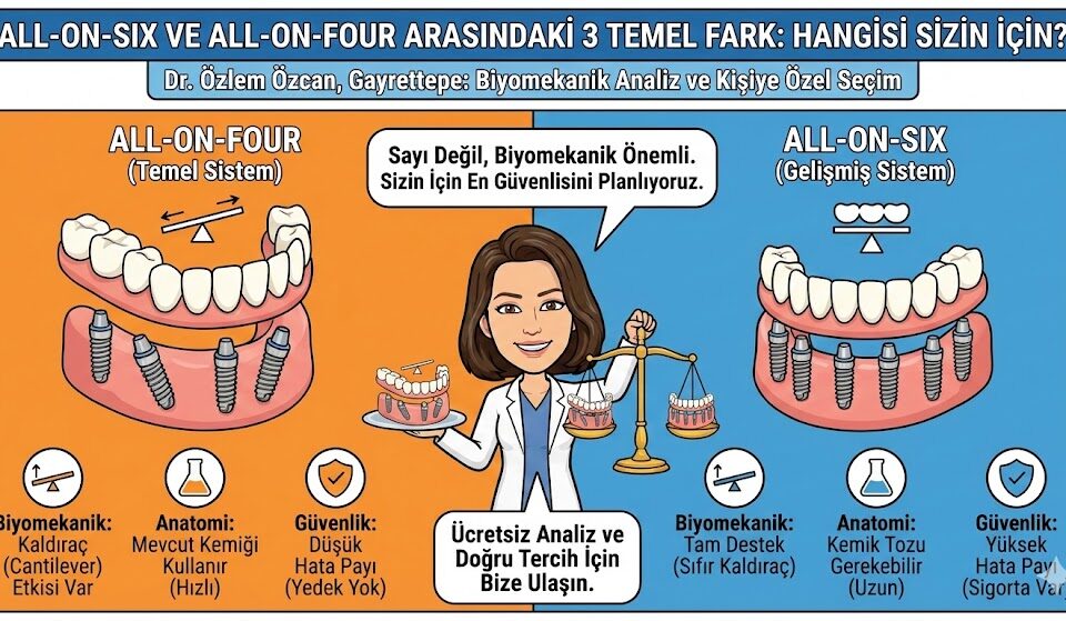 All-on-Six ve All-on-Four Arasındaki 3 Temel Fark