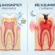 Diş Sızlaması ve Hassasiyeti Arasındaki Fark