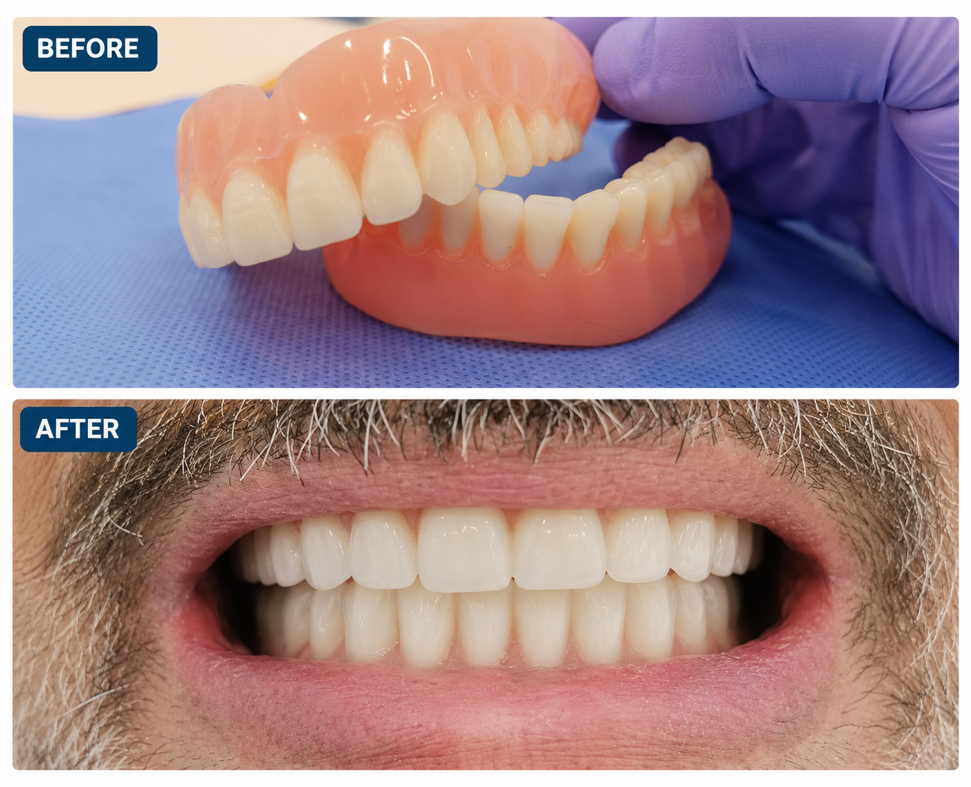 Real Patient Before & After Results