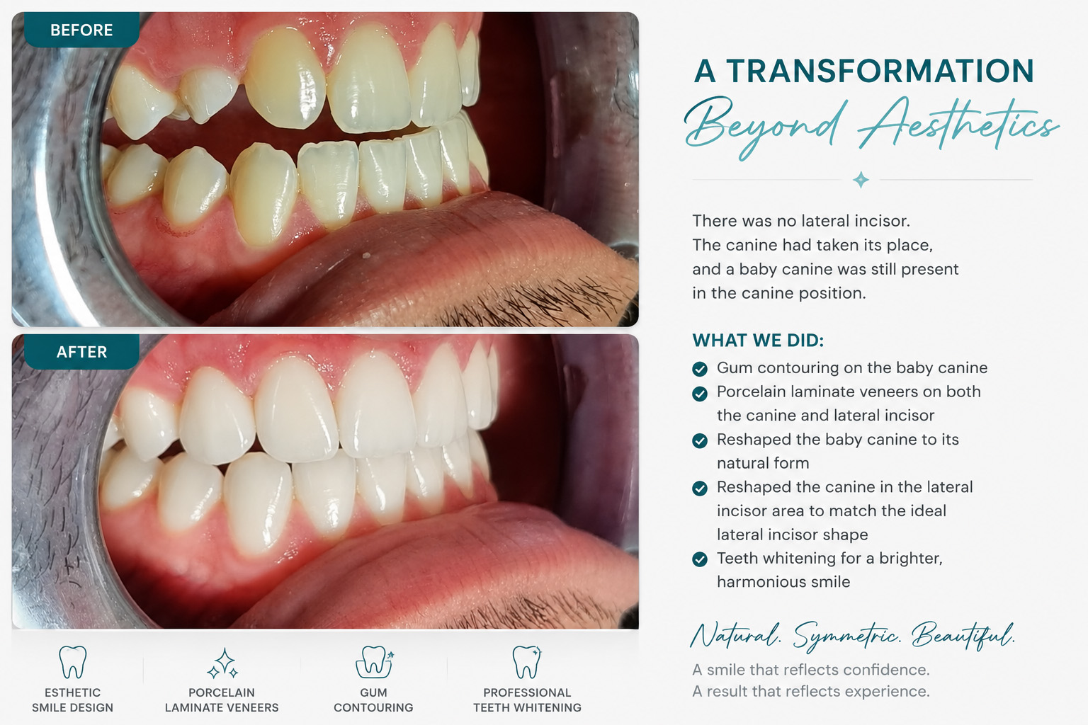 oncesi-sonrasi