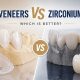 E-Max Veneers vs Zirconium Crowns: Which Is Better? 3 E-Max Veneers vs Zirconium Crowns: Which Is Better