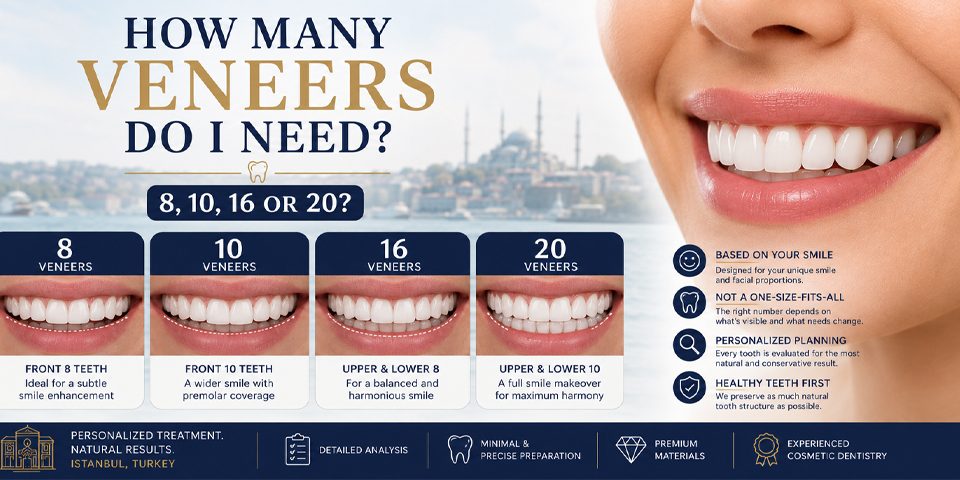 How Many Veneers Do I Need