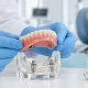 İmplant Destekli Hareketli Protez (Overdenture) Nedir? 2 İmplant Destekli Hareketli Protez (Overdenture) Nedir?