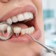 İmplant Enfeksiyonu (Peri-implantitis) Belirtileri 3 İmplant Enfeksiyonu (Peri-implantitis) Belirtileri