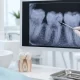 Diş Çatlakları Röntgende Görülür mü? 2 Diş Çatlakları Röntgende Görülür mü?