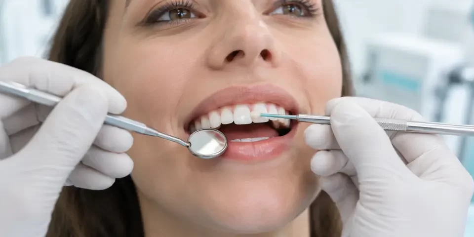 Ön Diş Dolgusu Nasıl Yapılır? Estetik ve Dayanıklılık