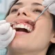 Gingivektomi Nedir? İyileşme Süreci Nasıldır? 3 Gingivektomi Nedir? İyileşme Süreci Nasıldır?