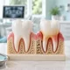 Periodontal Hastalık Nedir? 2 Periodontal Hastalık Nedir?